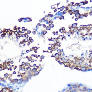 Immunohistochemistry analysis of paraffin-embedded mouse testis using Anti-JAB1 Antibody [ARC0895] (A306818) at a dilution of 1:100 (40x lens). Perform microwave antigen retrieval with 10 mM PBS buffer pH 7.2 before commencing with IHC staining protocol.