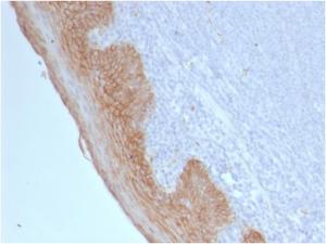 Anti-beta Catenin Mouse Monoclonal Antibody [clone: CTNNB1/2098]