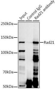 Immunoprecipitation analysis of 300 µg extracts of Jurkat cells using 3 µg of Anti-Rad21 Antibody (A305614). This Western blot was performed on the immunoprecipitate using Anti-Rad21 Antibody (A305614) at a dilution of 1:1000