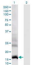 Anti-DAAM2 Mouse Monoclonal Antibody [clone: 1D8]