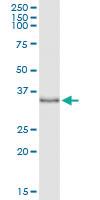 Anti-POLB Polyclonal Antibody Pair