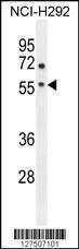 Anti-ADORA2A Rabbit Polyclonal Antibody (AP (Alkaline Phosphatase))