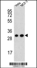 Anti-CYC1 Rabbit Polyclonal Antibody