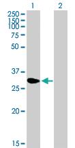 Anti-NME5 Mouse Polyclonal Antibody