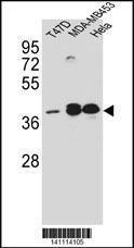 Anti-ESR2 Rabbit Polyclonal Antibody (FITC (Fluorescein Isothiocyanate))