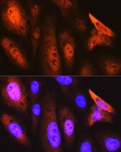 Immunofluorescence analysis of U-2 OS cells using Anti-JAB1 Antibody [ARC0895] (A306818) at a dilution of 1:100 (40x lens). DAPI was used to stain the cell nuclei (blue).