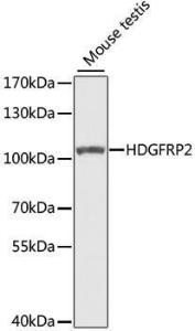 Western blot analysis of extracts of mouse testis, using Anti-HDGFRP2 Antibody (A7484) at 1:1,000 dilution