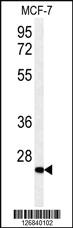 Anti-DHRS2 Rabbit Polyclonal Antibody