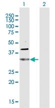 Anti-CDC34 Rabbit Polyclonal Antibody