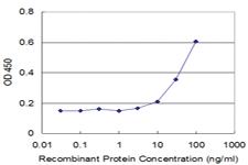 Anti-STK3 Mouse Monoclonal Antibody [clone: 1B3]