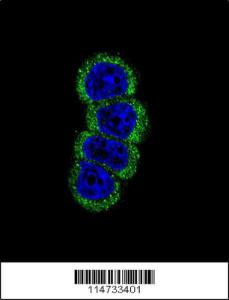 Anti-ERBB2 Rabbit Polyclonal Antibody