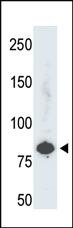 Anti-PFKL Rabbit Polyclonal Antibody