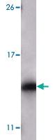 Anti-MAPKAPK5 Mouse Monoclonal Antibody [clone: 7H10B4]