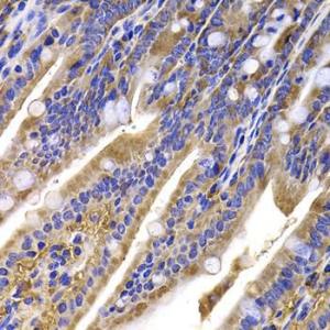 Immunohistochemistry of paraffin-embedded mouse ileum using Anti-HDGFRP2 Antibody (A7484) at dilution of 1:100 (40x lens)