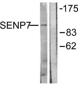 Western blot analysis of lysates from HUVEC cells using Anti-SENP7 Antibody. The right hand lane represents a negative control, where the Antibody is blocked by the immunising peptide