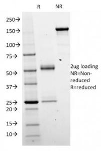 Anti-beta Catenin Mouse Monoclonal Antibody [clone: CTNNB1/2098]