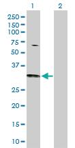 Anti-CDC42 Rabbit Polyclonal Antibody