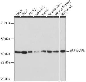 Western blot analysis of extracts of various cell lines, using Anti-p38 alpha / MAPK14 Antibody [ARC0201] (A308027) at 1:1,000 dilution. The secondary antibody was Goat Anti-Rabbit IgG H&L Antibody (HRP) at 1:10,000 dilution.