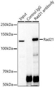 Immunoprecipitation analysis of 300 µg extracts of Jurkat cells using 3 µg of Anti-Rad21 Antibody (A305614). This Western blot was performed on the immunoprecipitate using Anti-Rad21 Antibody (A305614) at a dilution of 1:1000