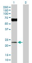 Anti-POFUT1 Rabbit Polyclonal Antibody