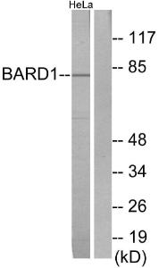 Western blot analysis of lysates from HeLa cells using Anti-BARD1 Antibody. The right hand lane represents a negative control, where the Antibody is blocked by the immunising peptide