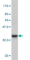 Anti-IRAK3 Mouse Monoclonal Antibody [clone: 1F6]