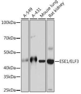 Western blot analysis of extracts of various cell lines, using Anti-ESE1 Antibody [ARC1191] (A306822) at 1:1000 dilution. The secondary Antibody was Goat Anti-Rabbit IgG H&L Antibody (HRP) at 1:10000 dilution. Lysates/proteins were present at 25 µg per lane