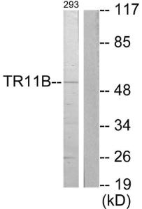 Western blot analysis of lysates from 293 cells using Anti-TR11B Antibody . The right hand lane represents a negative control, where the Antibody is blocked by the immunising peptide