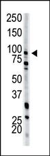 Anti-PFKM Rabbit Polyclonal Antibody