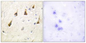 Immunohistochemical analysis of paraffin-embedded human brain tissue using Anti-SENP7 Antibody. The right hand panel represents a negative control, where the Antibody was pre-incubated with the immunising peptide