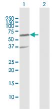 Anti-RNF25 Rabbit Polyclonal Antibody