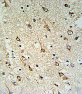 Anti-DNAJC6 Rabbit Polyclonal Antibody