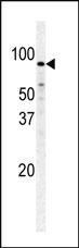 Anti-PFKM Rabbit Polyclonal Antibody