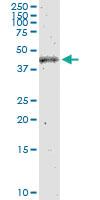 Anti-HADHB Rabbit Polyclonal Antibody