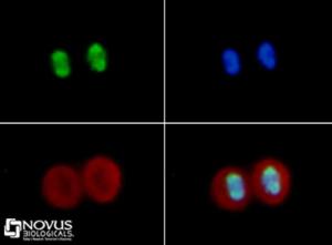 Anti-Niemann-Pick C1 Rabbit Polyclonal Antibody