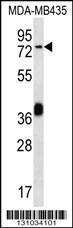 Anti-CEL Rabbit Polyclonal Antibody (HRP (Horseradish Peroxidase))