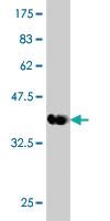 Anti-DYRK1A Mouse Monoclonal Antibody [clone: 7D10]