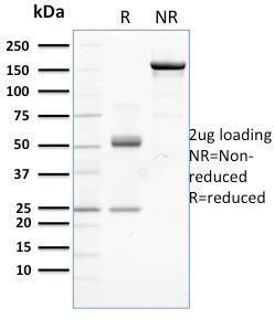 Anti-beta Catenin antibody