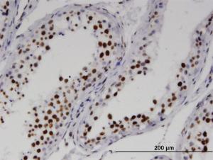 Anti-RNF25 Mouse Monoclonal Antibody [clone: 1D10]