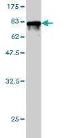 Anti-CAP1 Mouse Monoclonal Antibody [clone: 4A2]