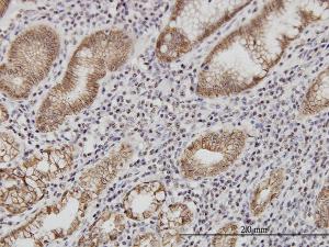 Anti-CDH1 Mouse Monoclonal Antibody [clone: 3F4]