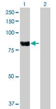 Anti-PLA2G6 Mouse Polyclonal Antibody