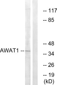 Anti-AWAT1 antibody