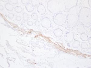 Immunohistochemical analysis of paraffin-embedded human Colon using Anti-Desmin Antibody