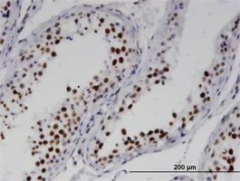 Anti-RNF25 Mouse Monoclonal Antibody [clone: 1D10]