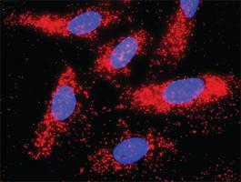 Anti-AKT1 Antibody Pair