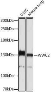 Western blot analysis of extracts of various cell lines, using Anti-WWC2 Antibody (A305615) at 1:1000 dilution. The secondary Antibody was Goat Anti-Rabbit IgG H&L Antibody (HRP) at 1:10000 dilution