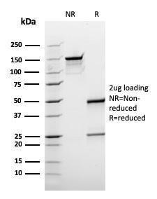 Antibody anti-BCL10 RBL10411 100 µg