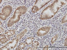 Anti-CDH1 Mouse Monoclonal Antibody [clone: 3F4]