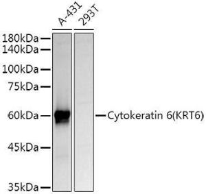 Anti-Cytokeratin 6a Rabbit Polyclonal Antibody